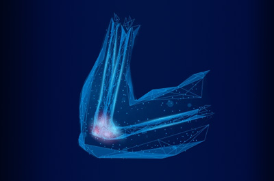 fisioterapia