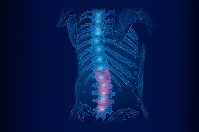 fisioterapia